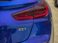kia-exceed-topline-panorama-aaaly-fy-2025-big-2